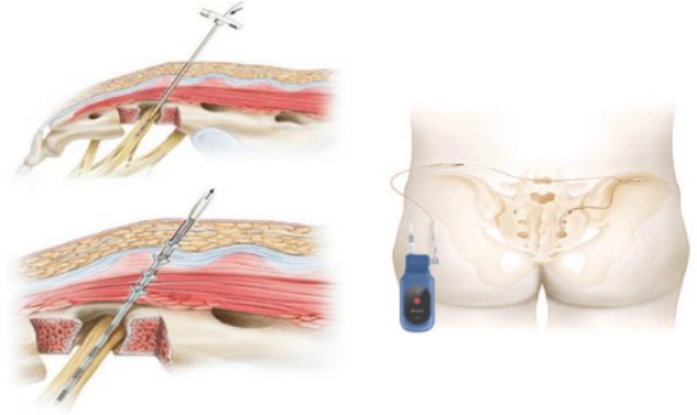 Snipaste_2025-12-01_10-44-23.jpg Snipaste_2025-12-01_10-44-23.jpg